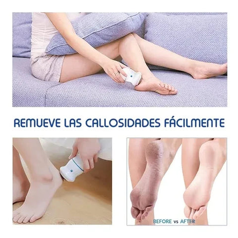 Pulidor De Callos Suaviza, Exfolia, Retira.