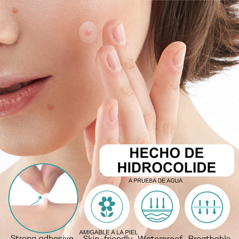 Tratamiento de Parches para el Acné